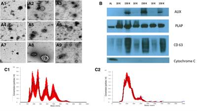 A cross-sectional analysis of syncytiotrophoblast membrane extracellular vesicles–derived transcriptomic biomarkers in early-onset preeclampsia
